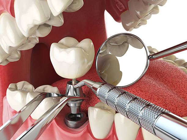 Best Emergency Treatment for Jaw Pain or Injury in Lake Goodwin, WA
